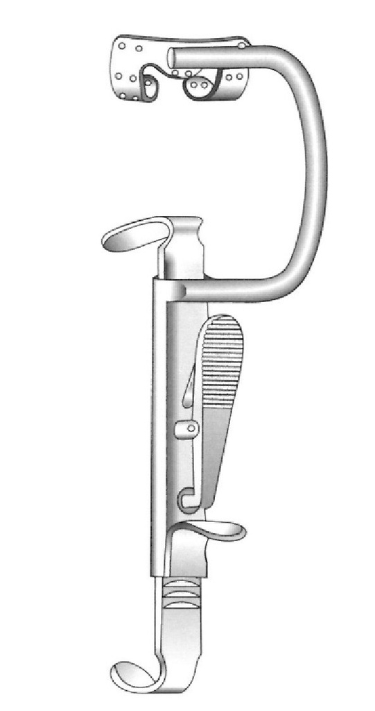 Abreboca Davis-Boyle, solo marco