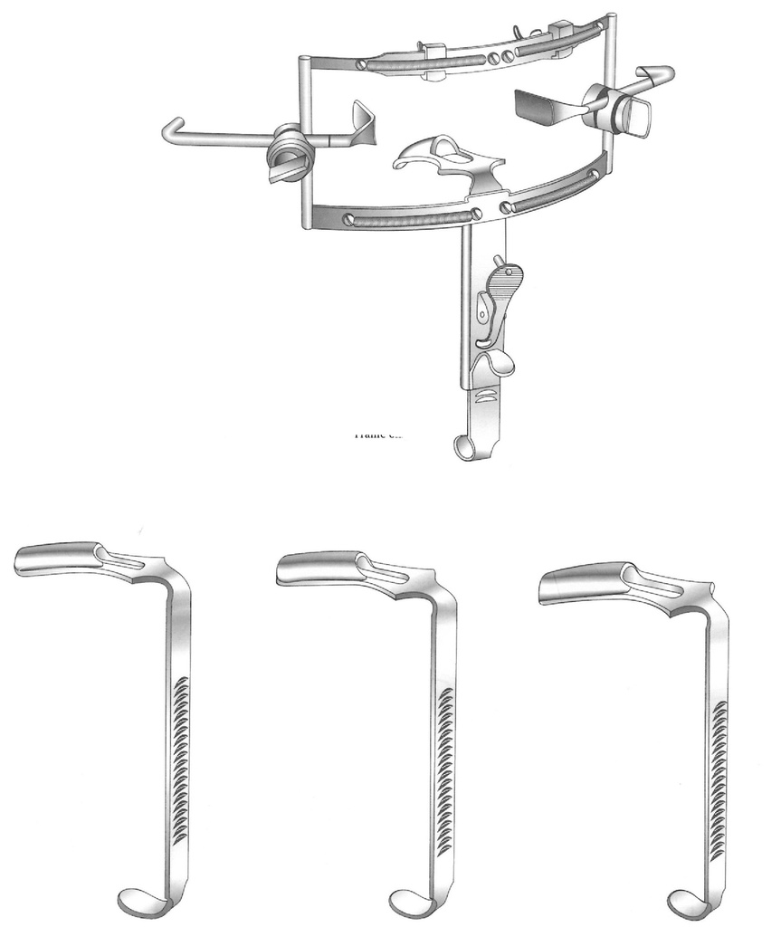 Open Dingmann, complete - length = 14.5 cm / 5-3 / 4 "