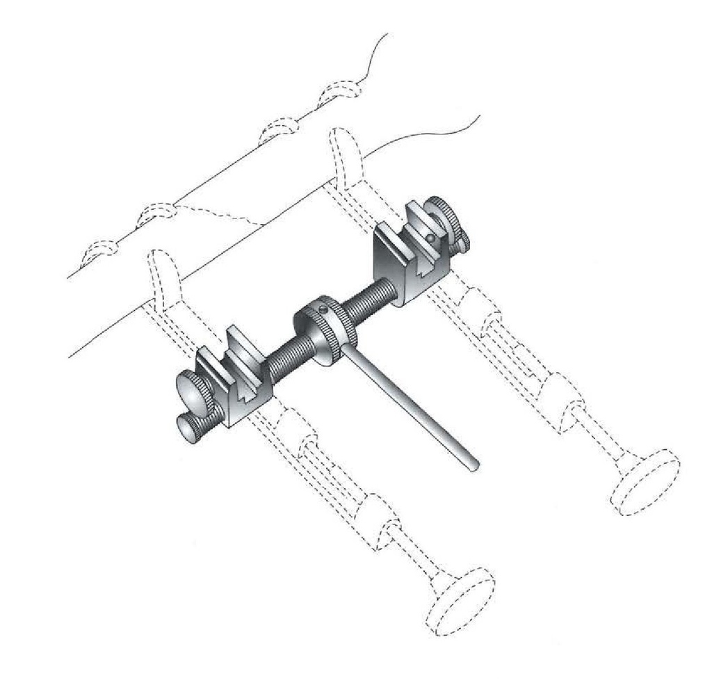Gerster traction bar