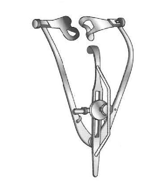 Guyton-Park Eye Speculum with Suture Posts, Blade = 14mm