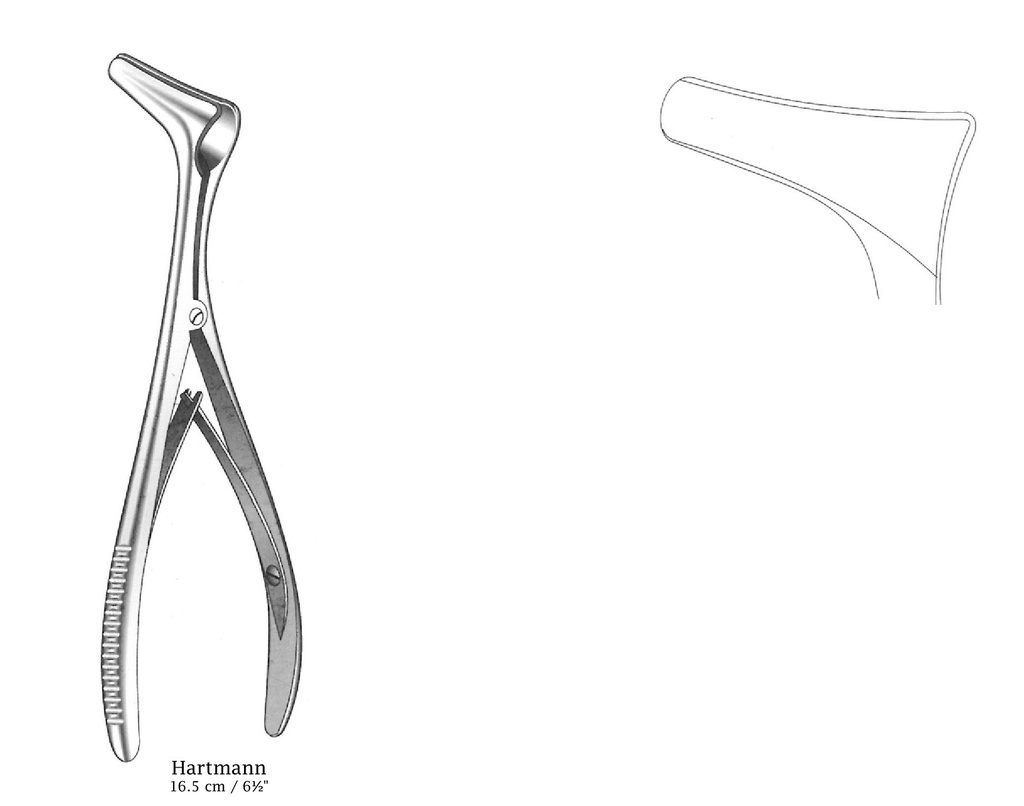 Nasal Hartmann, Figure 2