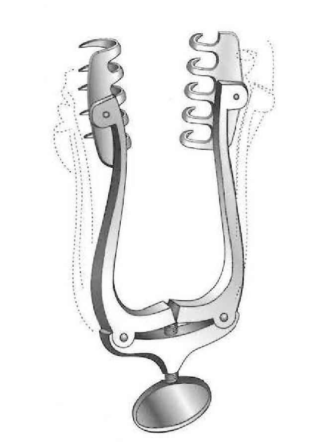 Jansen-Wagner separator