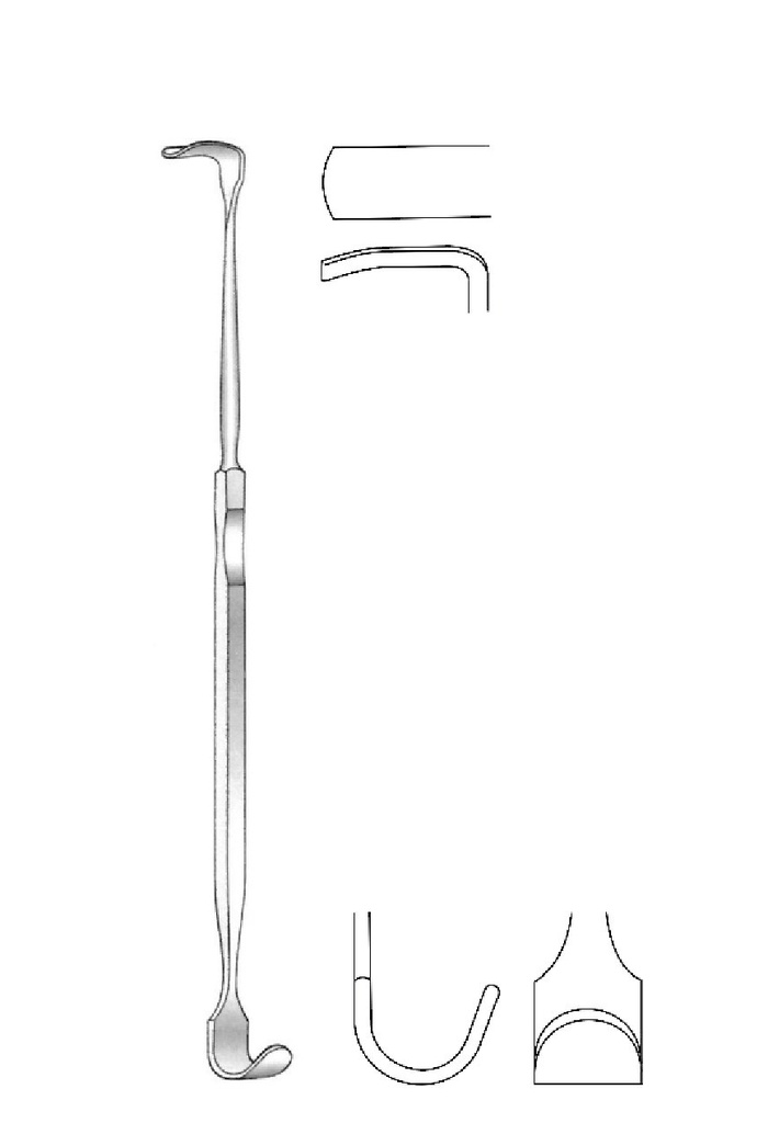 Separator for the Timo Lukens