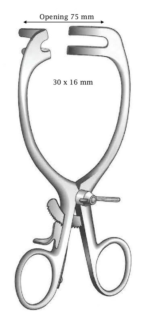 May-Adams separator