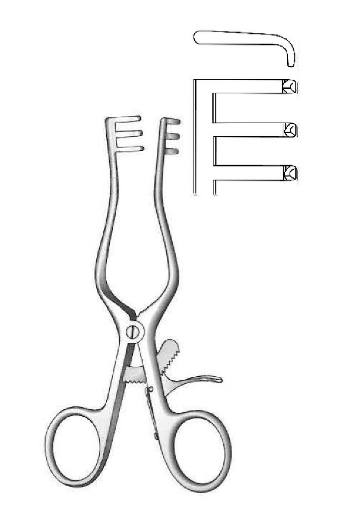 Milligan separator