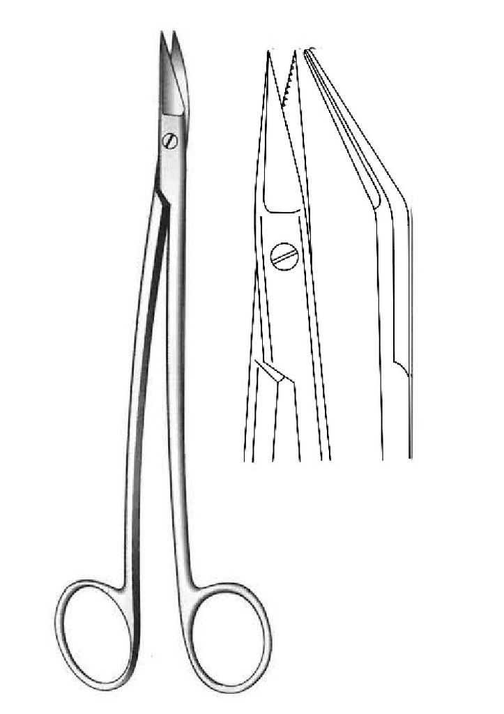 Neumann scissors, S -shaped