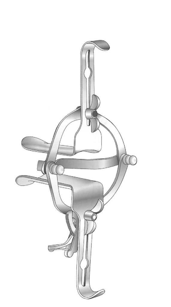 Vaginal separator o'sullivan-o'connor