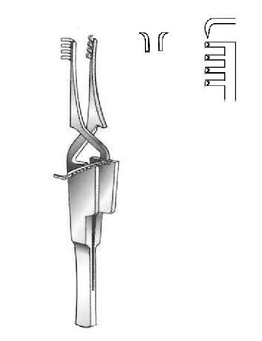 Holtzheimer separator, sharp