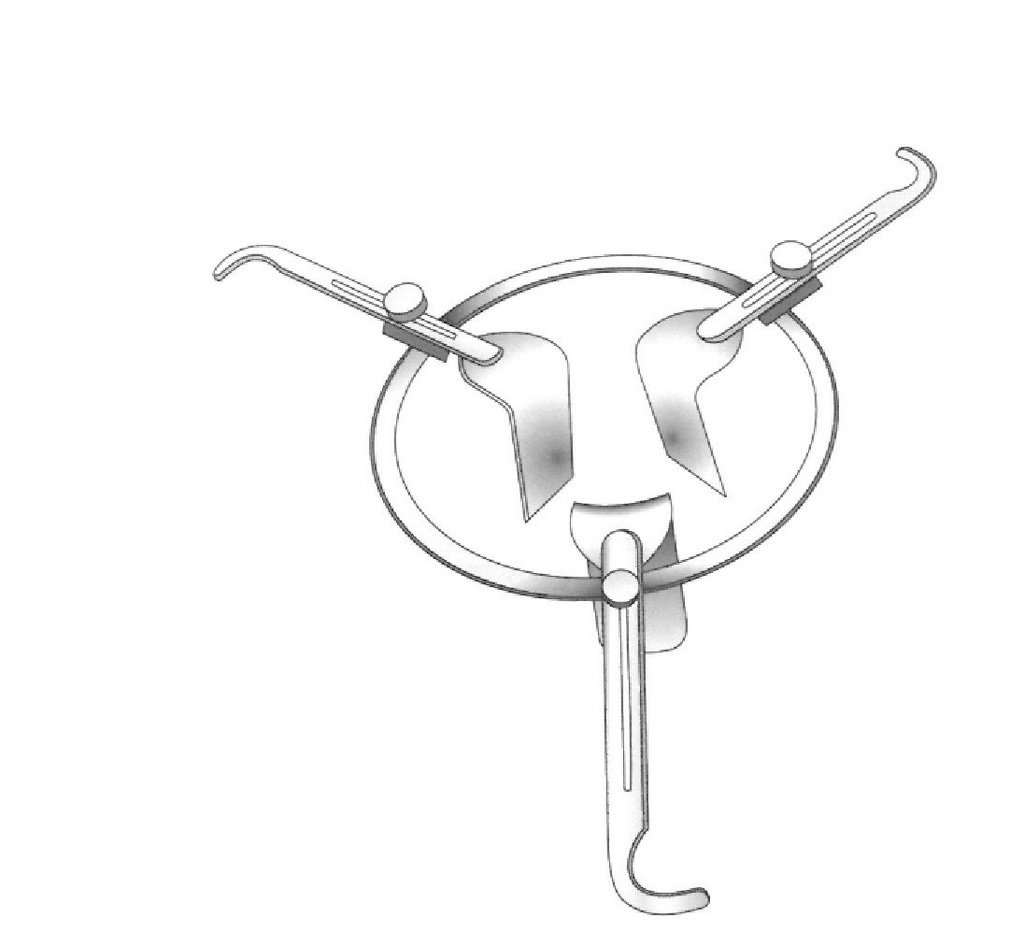 Retractor vaginal Smith