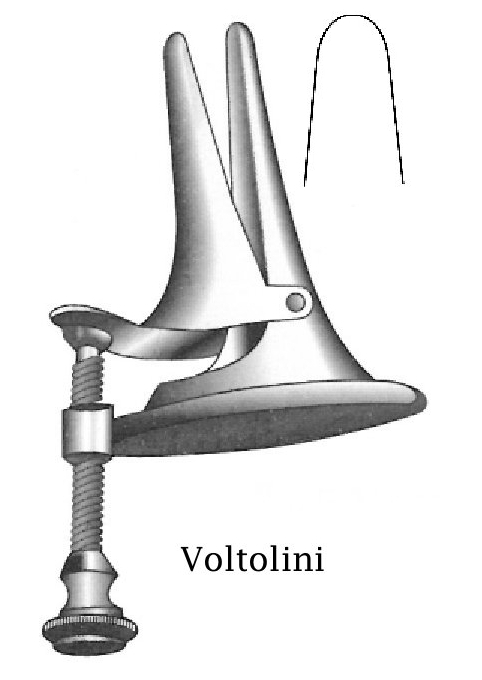 Espéculo nasal de Voltolini, pequeño