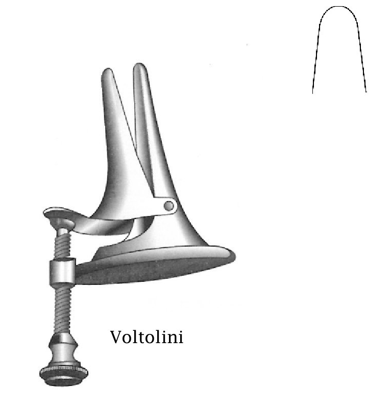Espéculo nasal de Voltolini, mediano