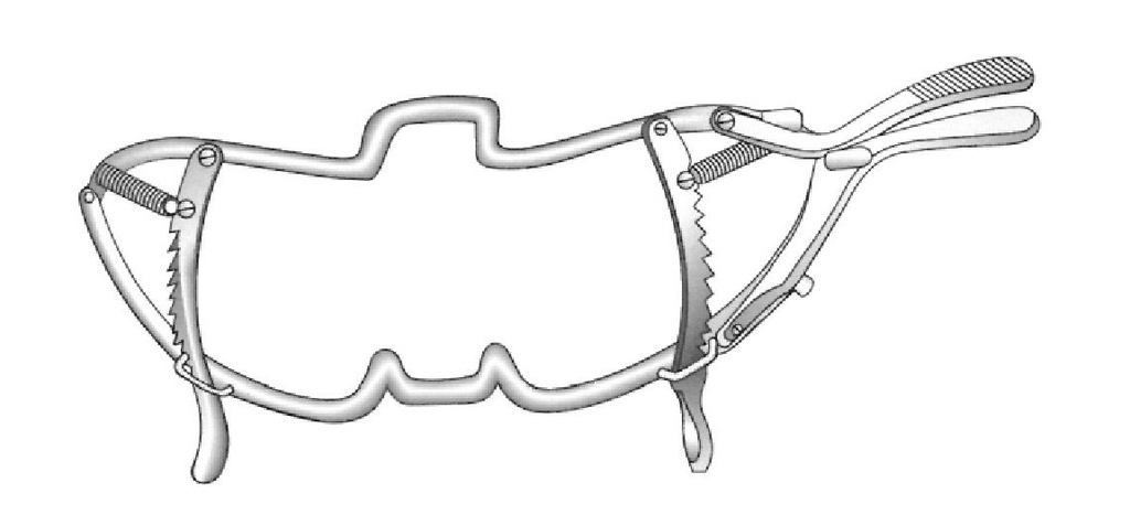 Abreboca Whitehead sin depresor de lengua - longitud = 15 cm / 6&quot;