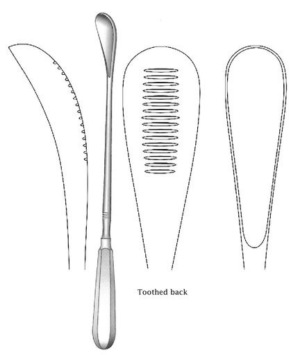 [IU-02225] Cureta uterina Cuzzi, dentada hacia atrás, desafilado, ancho = 14.5 mm - longitud = 30 cm / 12"