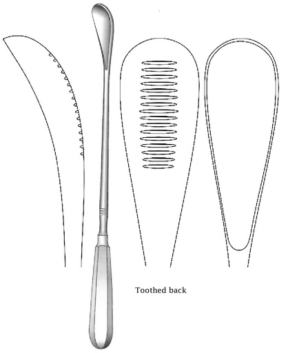 [IU-02227] Cureta uterina Cuzzi, dentada hacia atrás, desafilado, ancho = 21 mm - longitud = 30 cm / 12"