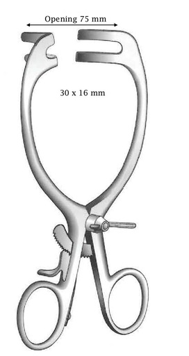 [IU-01416] May-Adams separator